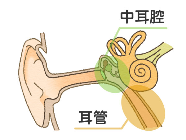 滲出性中耳炎のイメージ