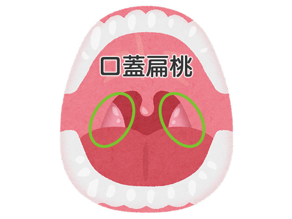 口蓋扁桃のイメージ